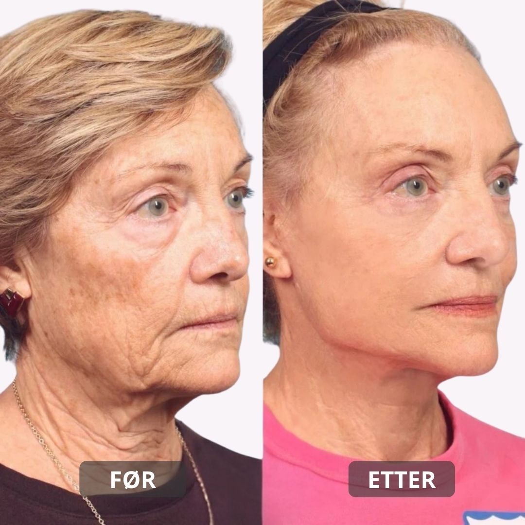 Lunaria Triple Kollagenkrem