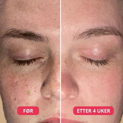 Lunaria Eksosom Spicule Shot Duo