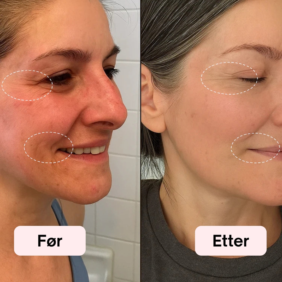 LED Lysterapi Ansiktsmaske 2.0