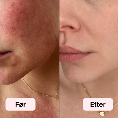 LED Lysterapi Ansiktsmaske 2.0