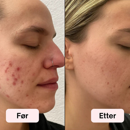 LED Lysterapi Ansiktsmaske 2.0