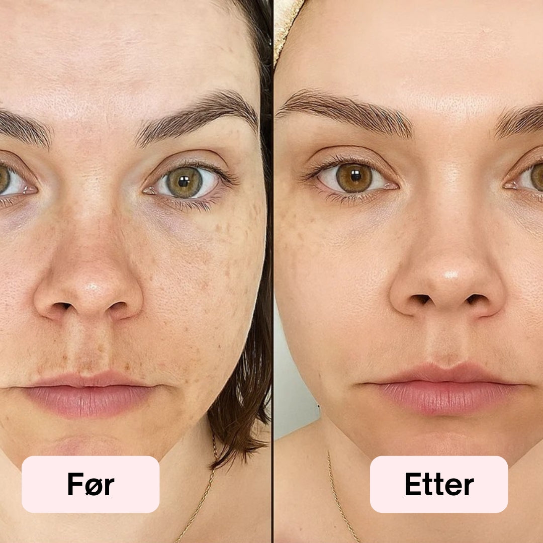 LED Lysterapi Ansiktsmaske 2.0