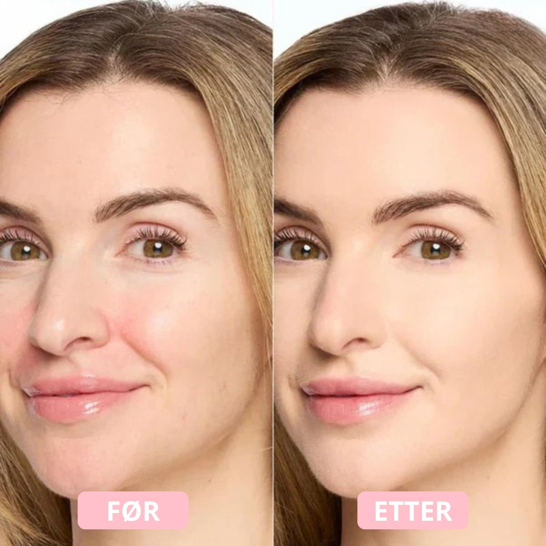 Lunaria Underøye-korrigerer