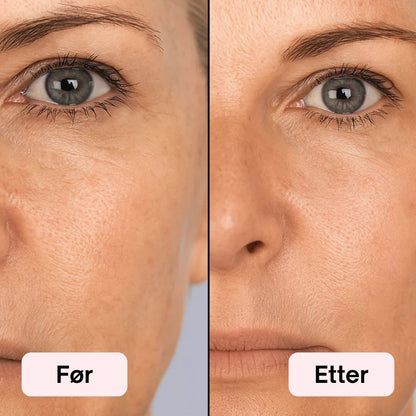 LED Lysterapi Ansiktsmaske 2.0