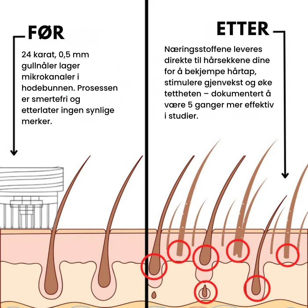 Lunaria Mikro-Infusjon Hårvekst