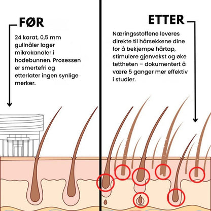 Lunaria Mikro-Infusjon Hårvekst