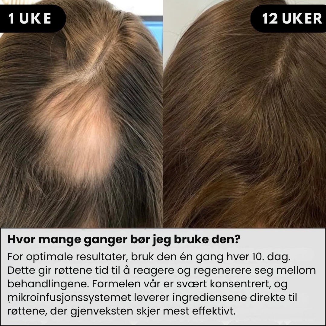 Lunaria Mikroinfusert Hårserum