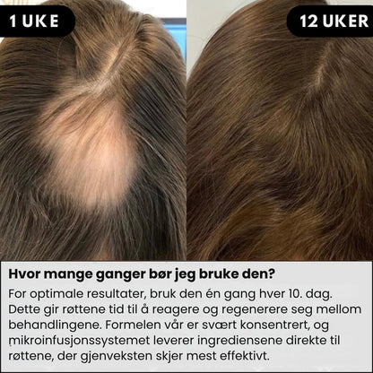 Lunaria Mikroinfusert Hårserum