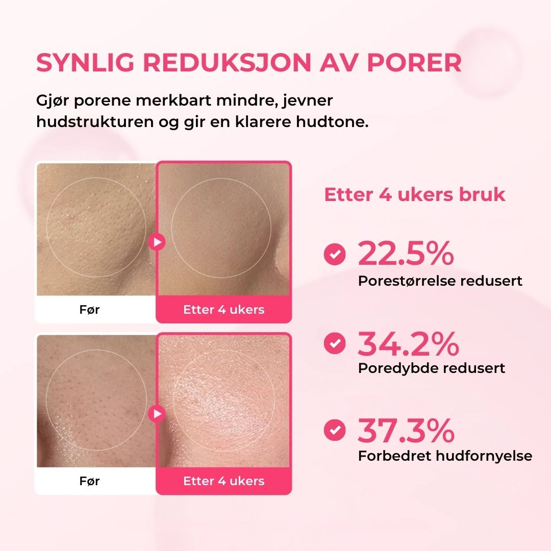 Lunaria Pore- og flekkpleie-duo