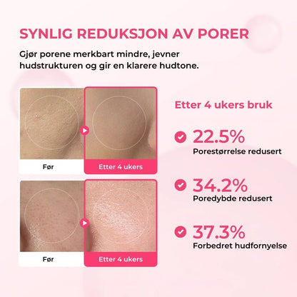 Lunaria Pore- og flekkpleie-duo