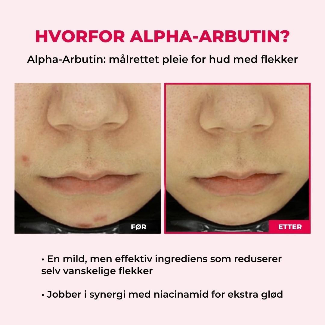 Lunaria Pore- og flekkpleie-duo