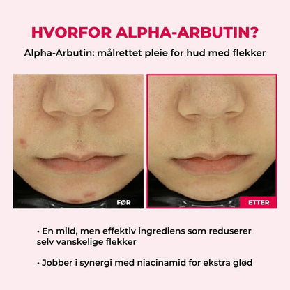 Lunaria Pore- og flekkpleie-duo