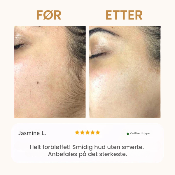 Bali&co™ Instant Hårfjerningssett