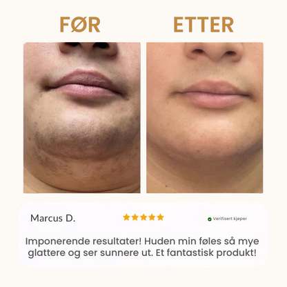 Bali&co™ Instant Hårfjerningssett