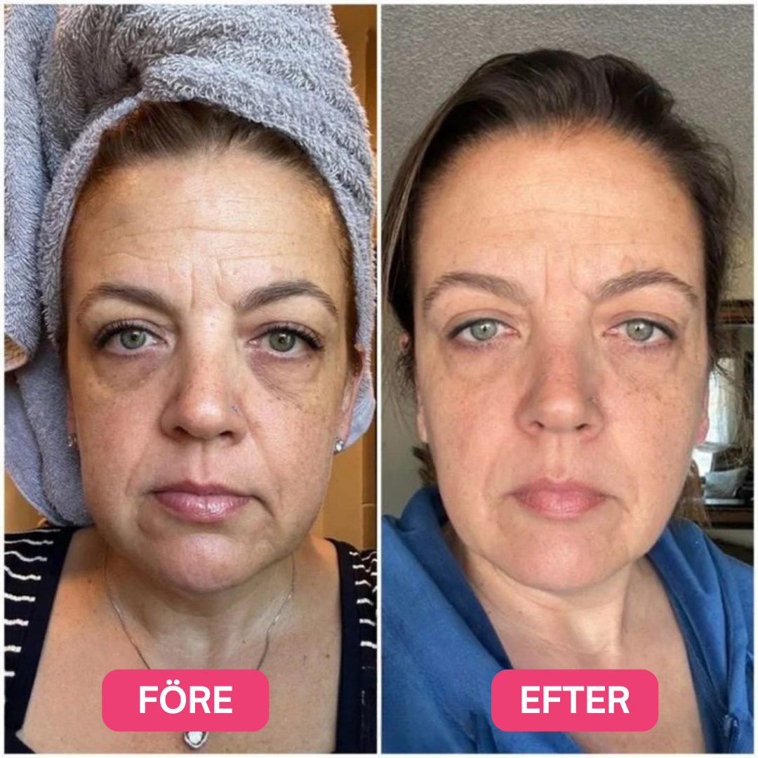 4D LED Lysterapi Ansiktsmask