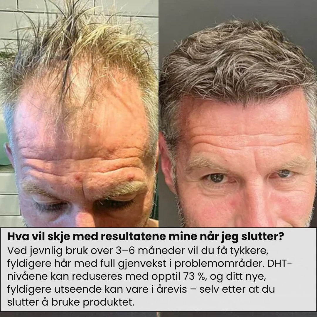 Lunaria Mikro-Infusjon Hårvekst