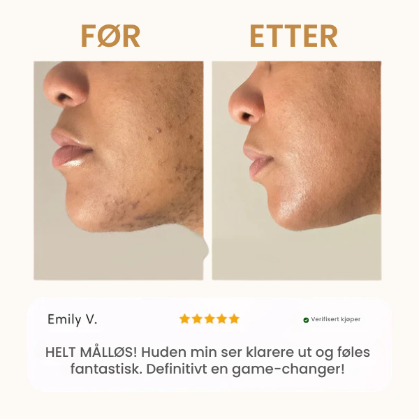 Bali&co™ Instant Hårfjerningssett