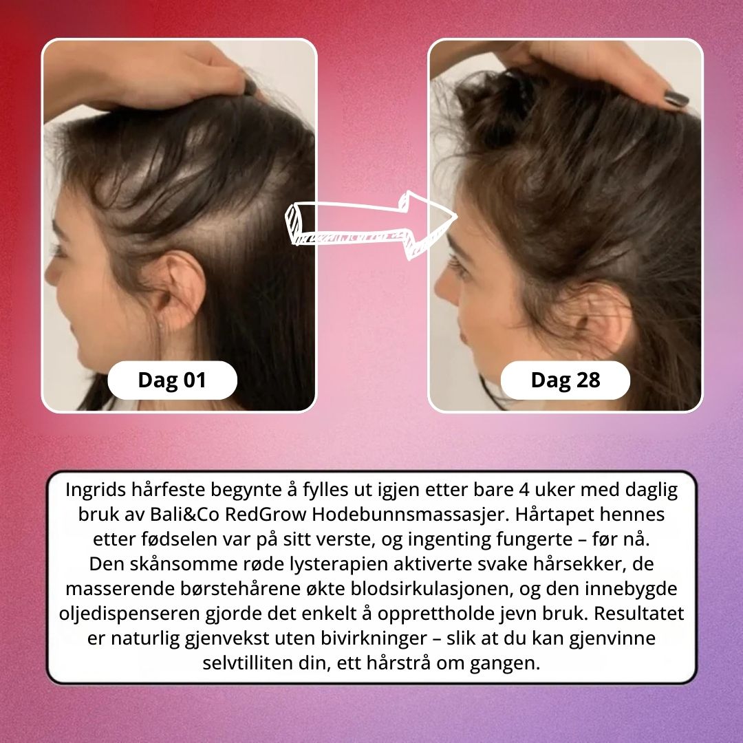 Bali&Co RedGrow Hodebunnsmassasjer