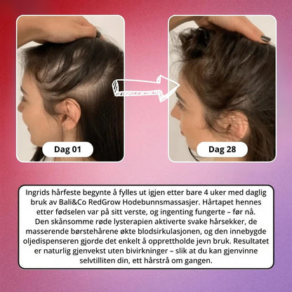 Bali&Co RedGrow Hodebunnsmassasjer