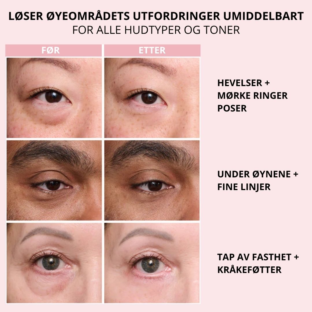 Lunaria Øyeblikkelig Ansiktsstrammer