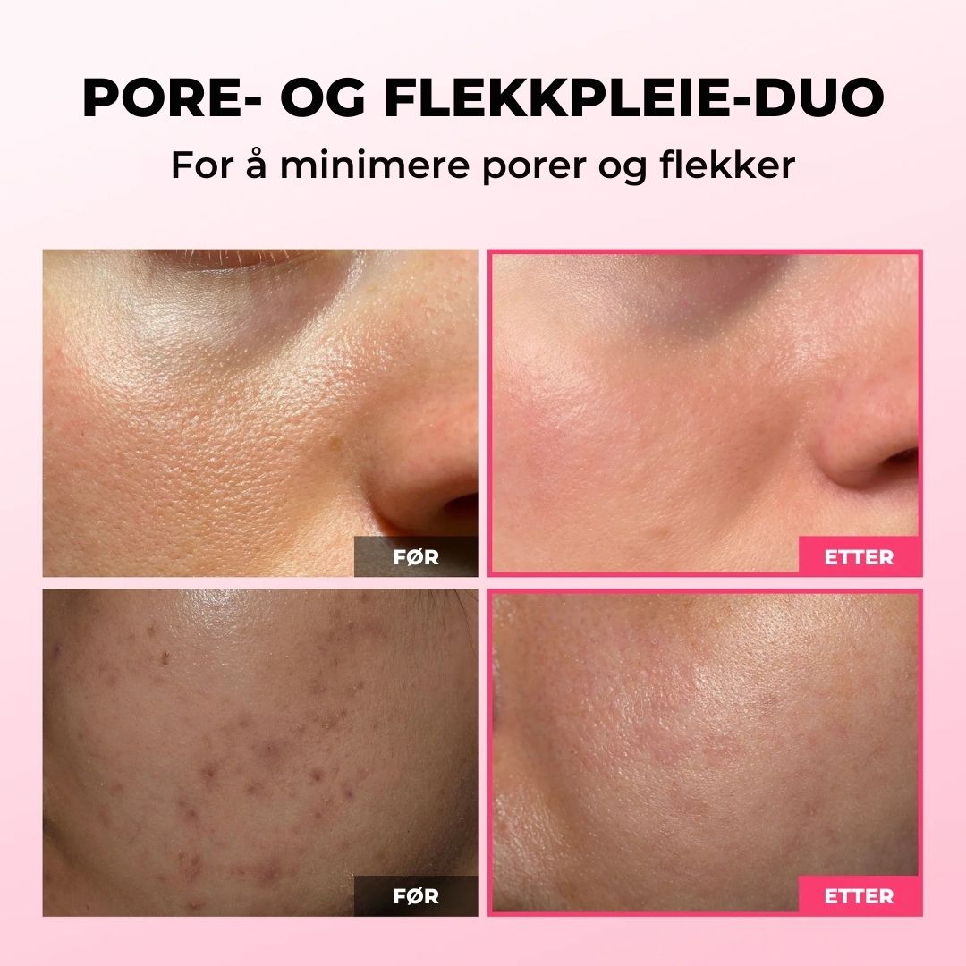 Lunaria Pore- og flekkpleie-duo