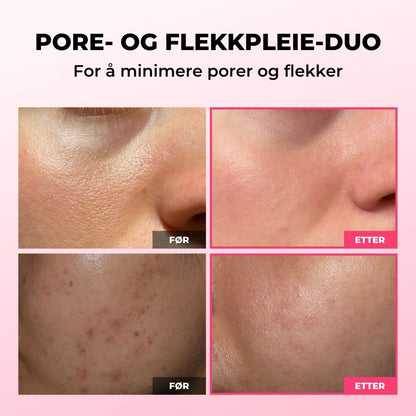 Lunaria Pore- og flekkpleie-duo