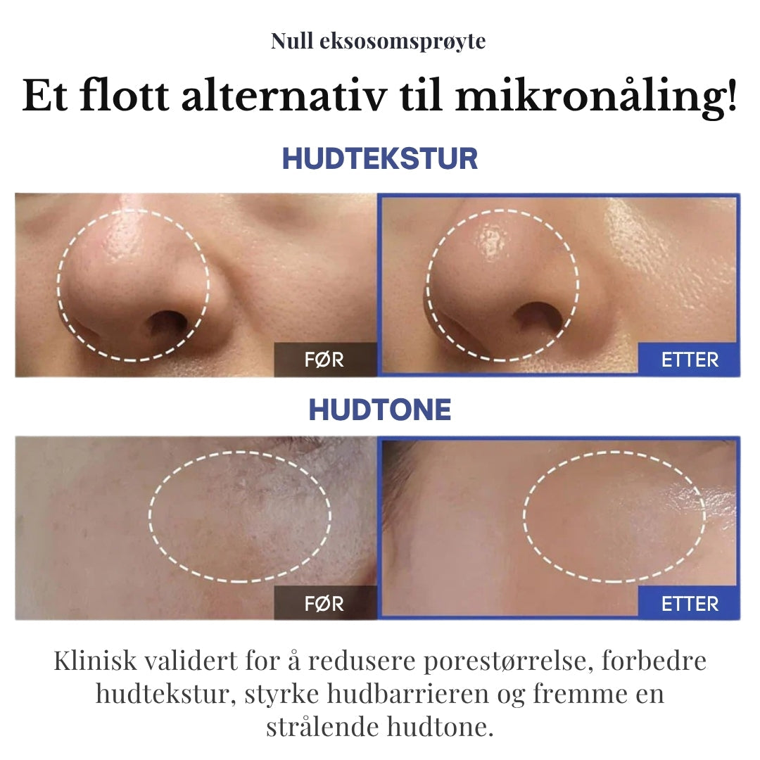 Lunaria Éndags Eksosom-Shot Poreampulle