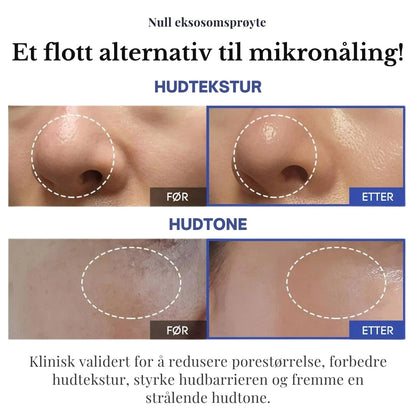 Lunaria Éndags Eksosom-Shot Poreampulle