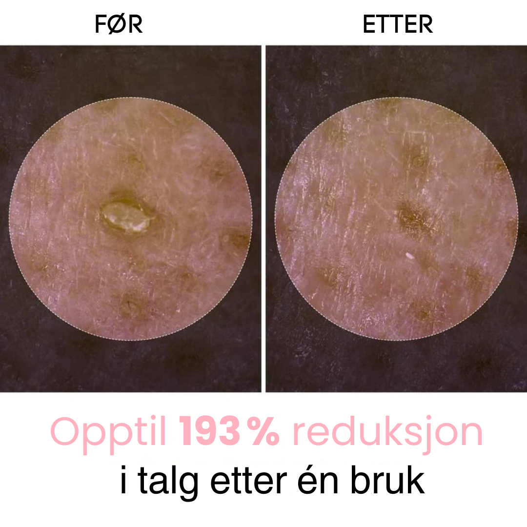 Lunaria™ Peel Shot Glow risampulle-duo