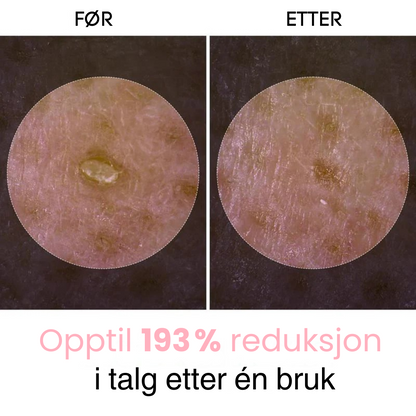 Lunaria™ Peel Shot Glow risampulle-duo