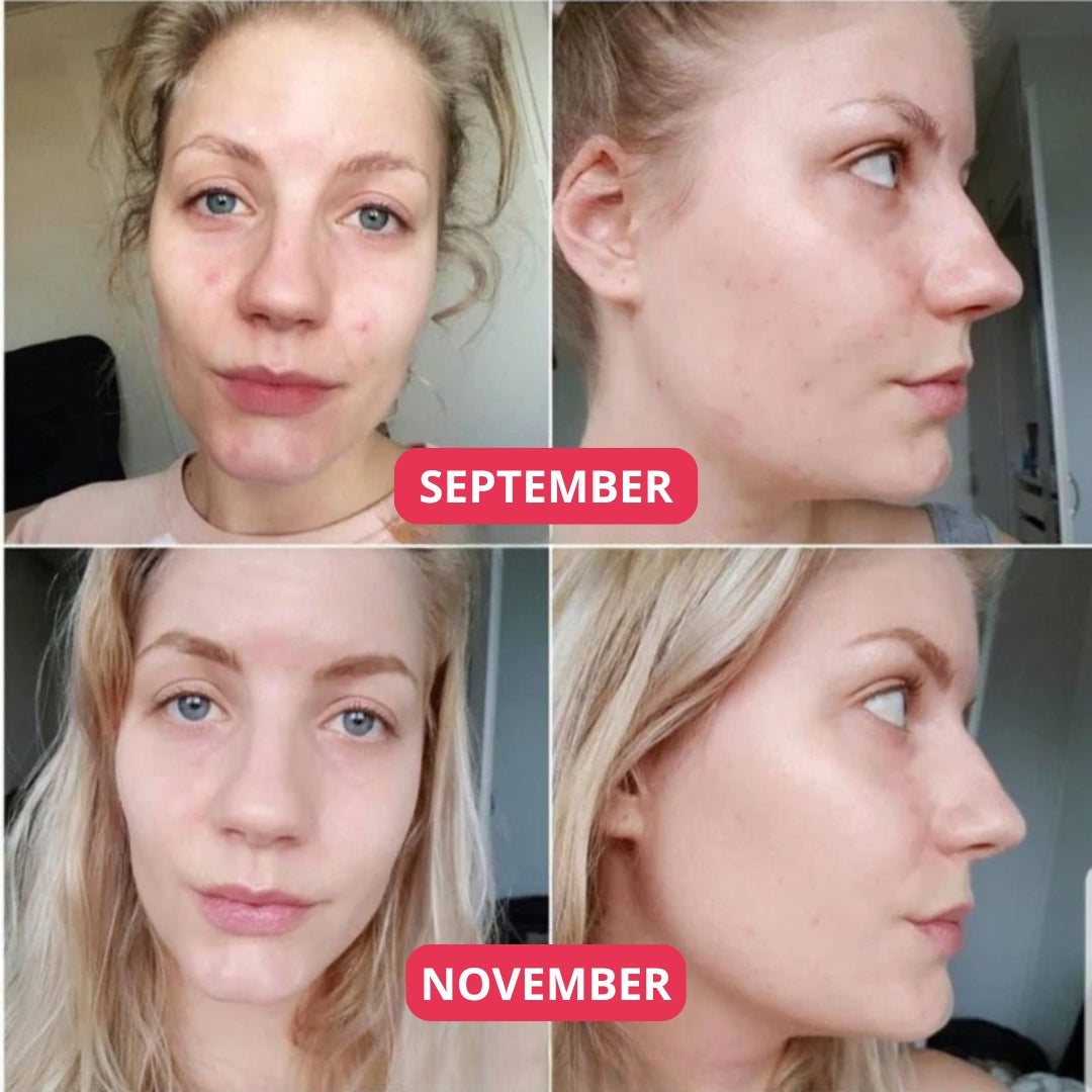 Lunaria Eksosom Spicule Shot Duo