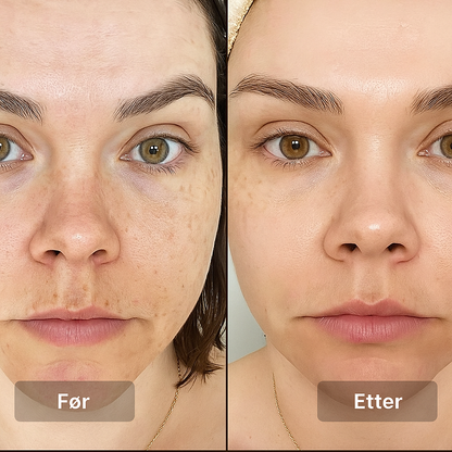 LED Lysterapi Ansiktsmaske - BARE 24 TIMER