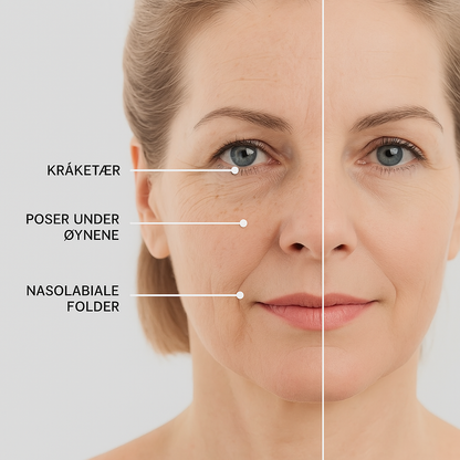 ArcticLift Øyepads (3 par)