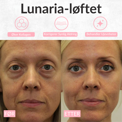 Lunaria™ Øye & Nakke Duo